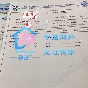 HCG 314.30 ɹУ